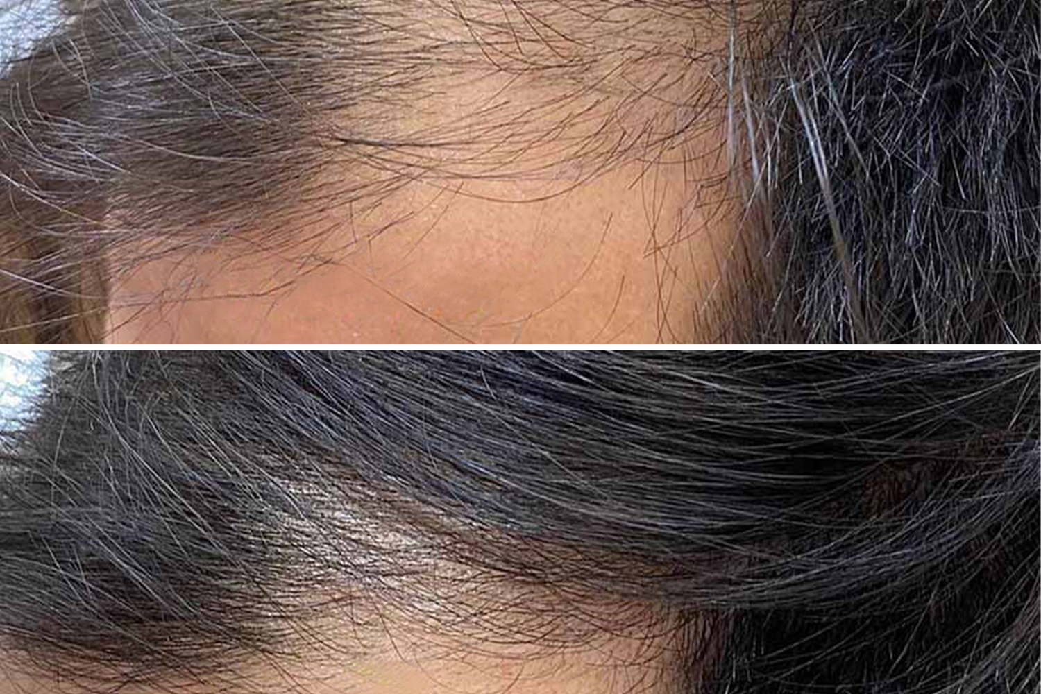 PhiLings treatment performed by Master Associate Saba Barati PhiLings treatment performed by Master Associate Saba Barati